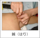 鍼（はり）