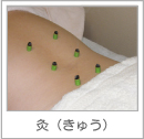 灸（きゅう）