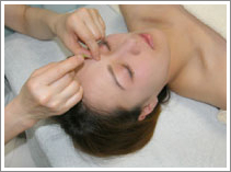 美容鍼（美容ばり）